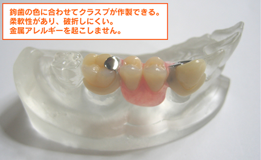 鉤歯の色に合わせてクラスプが作製できる。柔軟性があり、破折しにくい。金属アレルギーを起こしません。